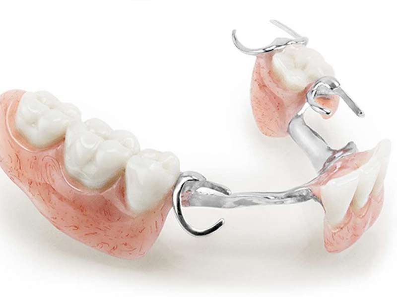 Dental additions