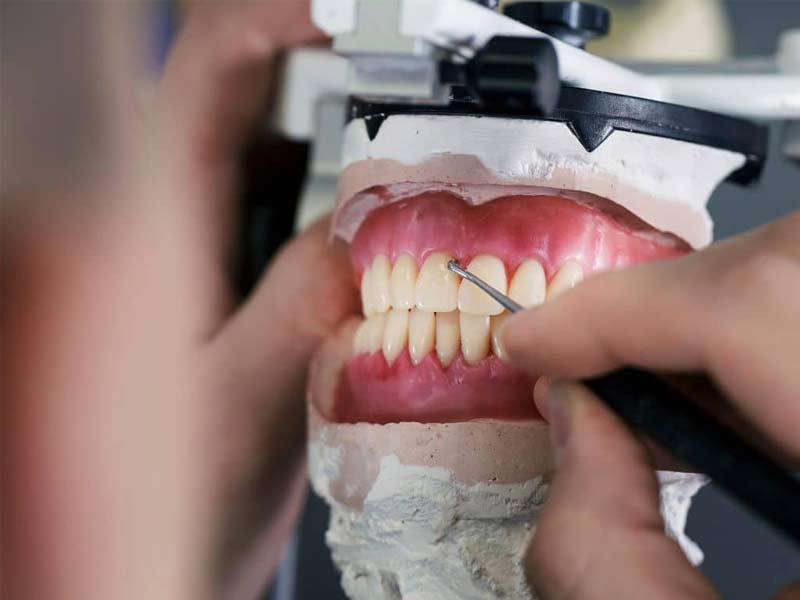 Dental repairs