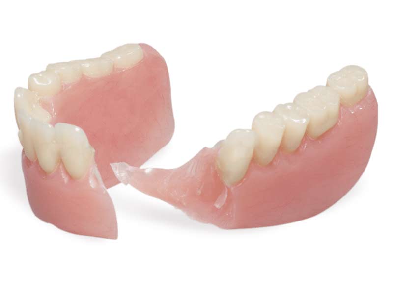 Denture Repairs Lifestyle Dentures Rolleston Christchurch