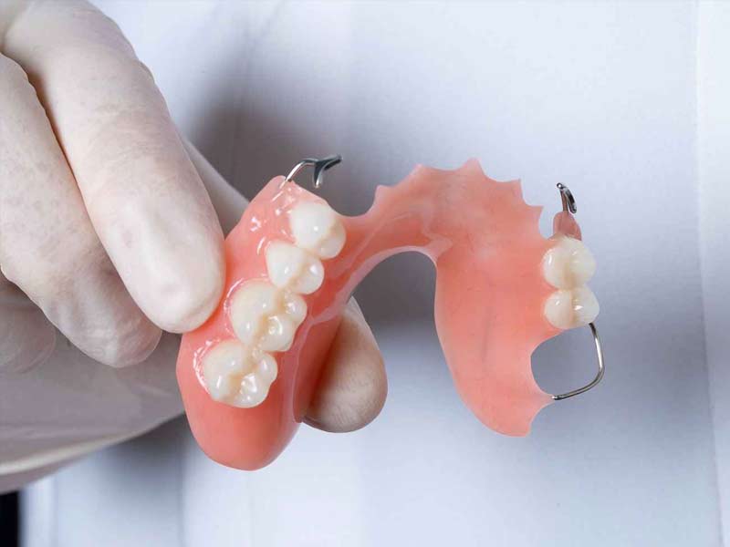 partial dentures